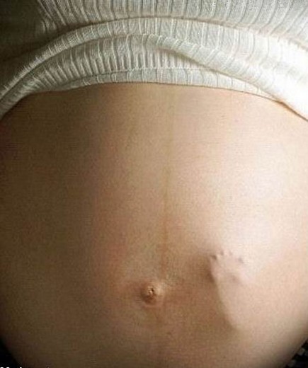NOTICIA MALA DE LA SEMANA: “Frivolizar con el aborto”